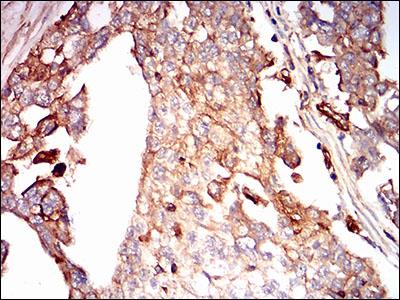 Immunohistochemistry (Formalin/PFA-fixed paraffin-embedded sections) - Anti-Syndecan-1 antibody [1A3H4] (AB181789), expandable thumbnail