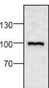 Western blot - Anti-Syndecan-1 antibody (AB60199)