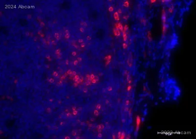Immunohistochemistry (Formalin/PFA-fixed paraffin-embedded sections) - Anti-Syndecan-1 antibody [EPR6454] - BSA and Azide free (AB226108)
