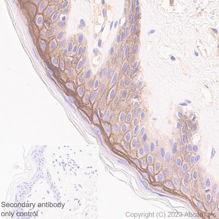 Immunohistochemistry (Formalin/PFA-fixed paraffin-embedded sections) - Anti-Syndecan-1 antibody [EPR6454] - BSA and Azide free (AB226108)