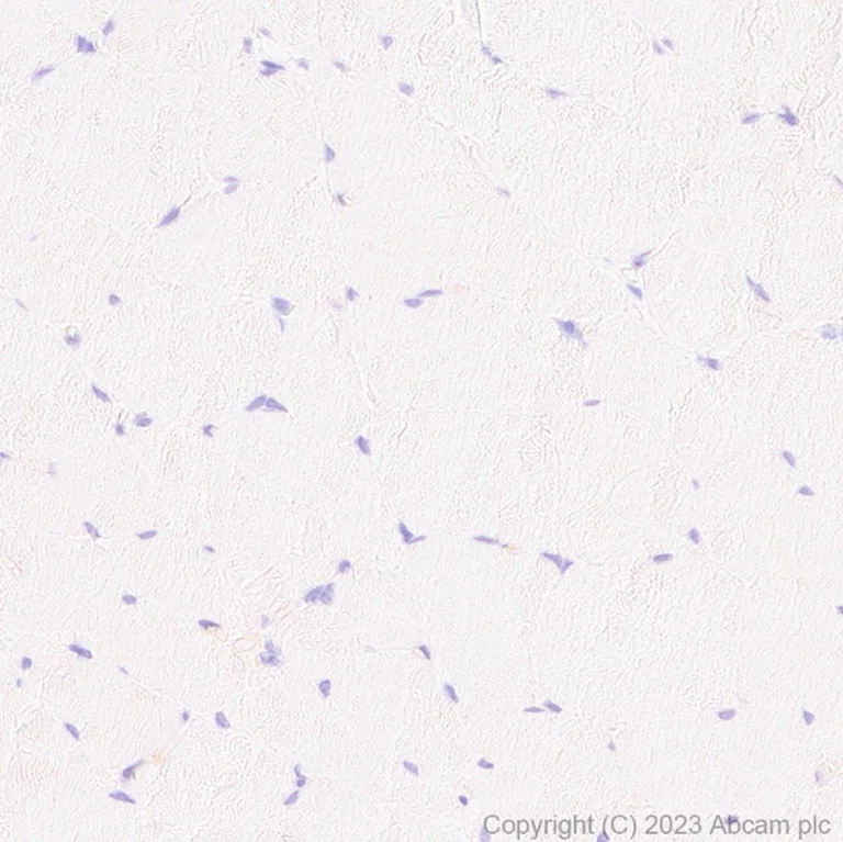 Immunohistochemistry (Formalin/PFA-fixed paraffin-embedded sections) - Anti-Syndecan-1 antibody [EPR6454] - BSA and Azide free (AB226108)