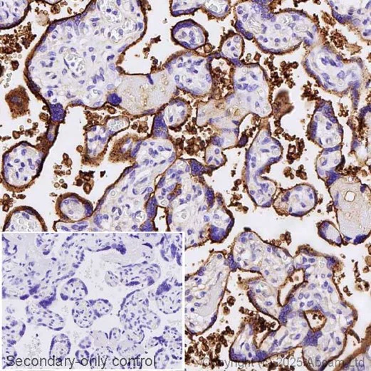 Immunohistochemistry (Formalin/PFA-fixed paraffin-embedded sections) - Anti-Syndecan-1 antibody [EPR6454] - Low endotoxin, Azide free (AB216458)