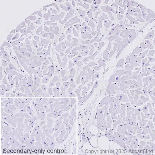 Immunohistochemistry (Formalin/PFA-fixed paraffin-embedded sections) - Anti-Syndecan-1 antibody [EPR6454] - Low endotoxin, Azide free (AB216458)