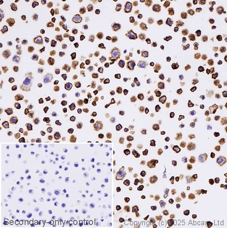 Immunohistochemistry (Formalin/PFA-fixed paraffin-embedded sections) - Anti-Syndecan-1 antibody [EPR6454] - Low endotoxin, Azide free (AB216458)