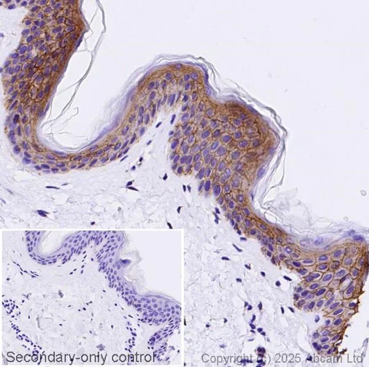 Immunohistochemistry (Formalin/PFA-fixed paraffin-embedded sections) - Anti-Syndecan-1 antibody [EPR6454] - Low endotoxin, Azide free (AB216458)