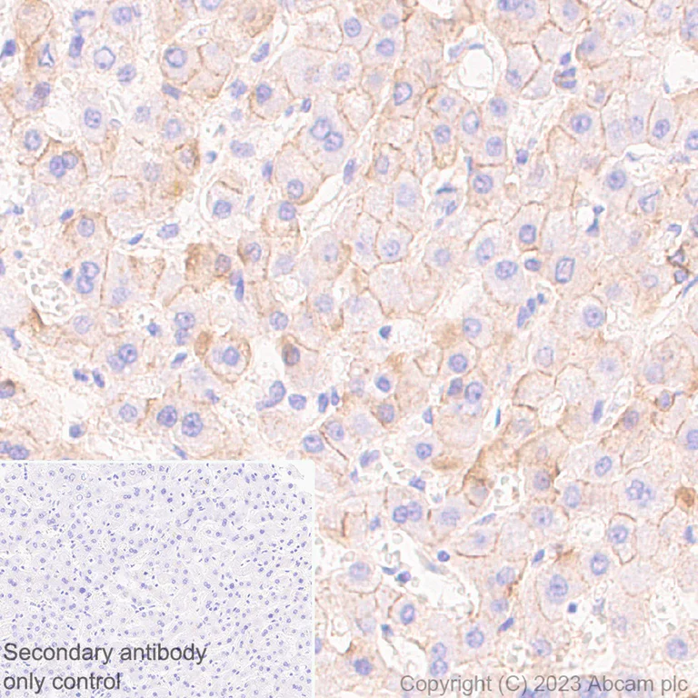 Immunohistochemistry (Formalin/PFA-fixed paraffin-embedded sections) - Anti-Syndecan-1 antibody [EPR6454] - Low endotoxin, Azide free (AB216458)