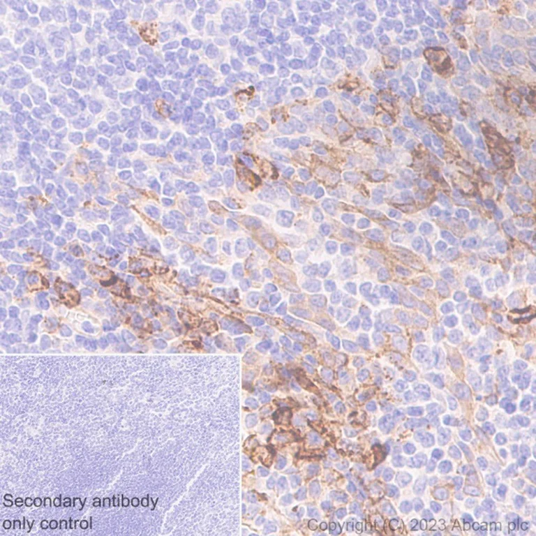Immunohistochemistry (Formalin/PFA-fixed paraffin-embedded sections) - Anti-Syndecan-1 antibody [EPR6454] - Low endotoxin, Azide free (AB216458)