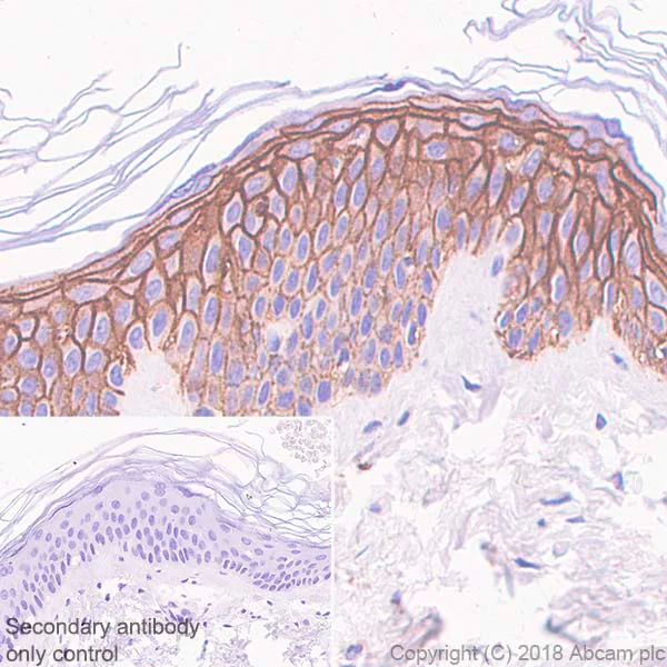 Immunohistochemistry (Formalin/PFA-fixed paraffin-embedded sections) - Anti-Syndecan-1 antibody [SP152] - BSA and Azide free (AB242394)
