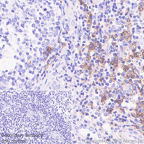 Immunohistochemistry (Formalin/PFA-fixed paraffin-embedded sections) - Anti-Syndecan-1 antibody [SP152] - BSA and Azide free (AB242394)