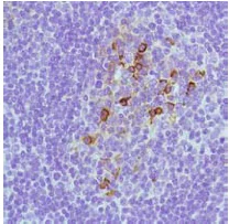 Immunohistochemistry (Formalin/PFA-fixed paraffin-embedded sections) - Anti-Syndecan-1 antibody [SP152] - BSA and Azide free (AB242394)