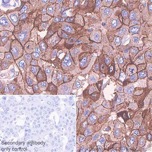 Immunohistochemistry (Formalin/PFA-fixed paraffin-embedded sections) - Anti-Syndecan-1 antibody [SP152] - BSA and Azide free (AB242394)