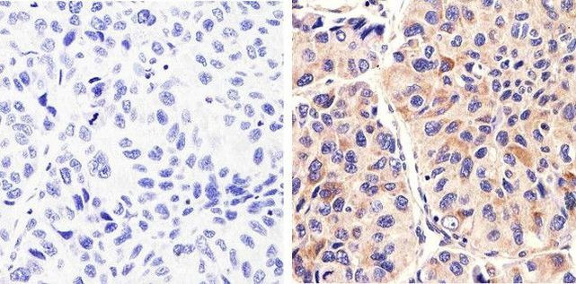 Immunohistochemistry (Formalin/PFA-fixed paraffin-embedded sections) - Anti-Syndecan 2/HSPG antibody [RP23040036] (AB308031)
