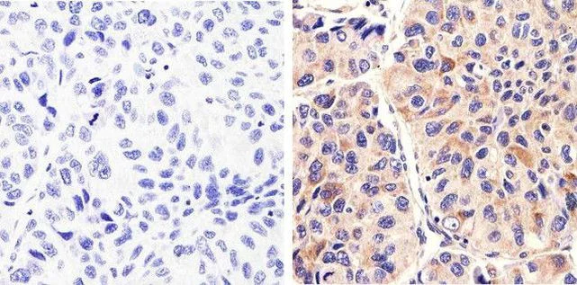 Immunohistochemistry (Formalin/PFA-fixed paraffin-embedded sections) - Anti-Syndecan 2/HSPG antibody [RP23040036] (AB308031)