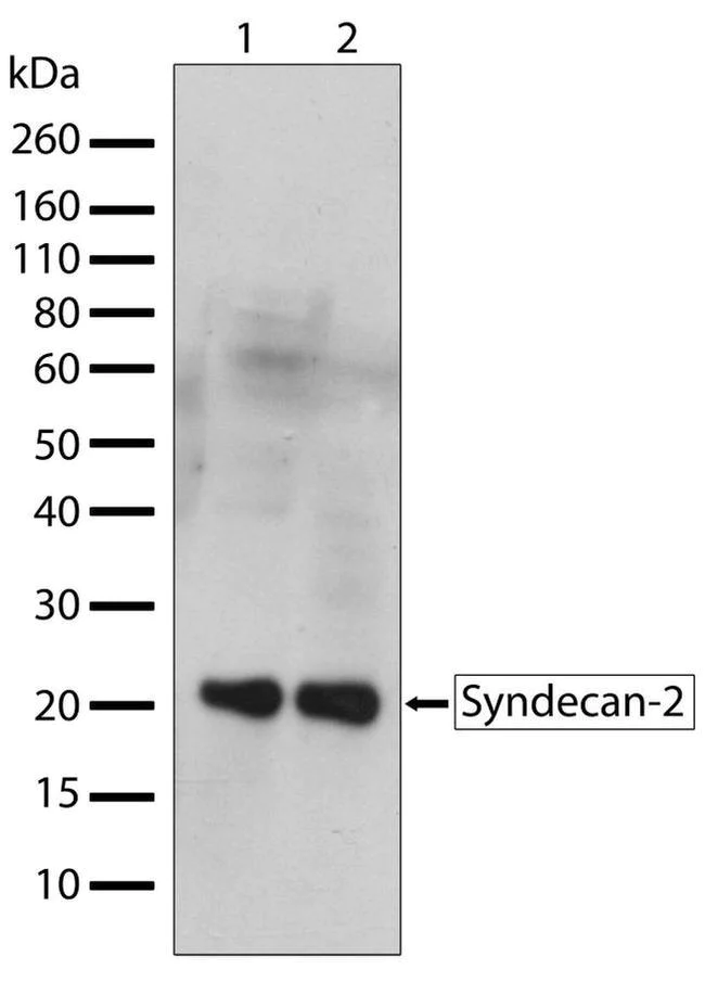 Western blot - Anti-Syndecan 2/HSPG antibody [RP23040036] (AB308031)
