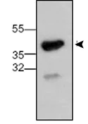 Western blot - Anti-Syndecan 3 antibody (AB63932)