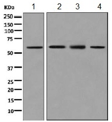 Western blot - Anti-Syndecan 3 antibody [EPR10648] - BSA and Azide free (AB249207), expandable thumbnail