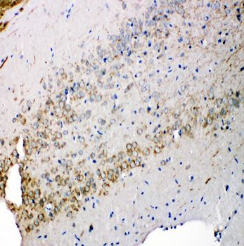 Immunohistochemistry (Formalin/PFA-fixed paraffin-embedded sections) - Anti-Syndecan 3 antibody - N-terminal (AB191308)