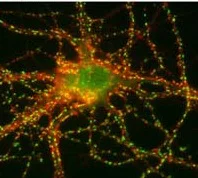 Immunocytochemistry/ Immunofluorescence - Anti-SynGAP antibody (AB3344)