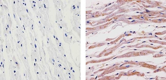 Immunohistochemistry (Formalin/PFA-fixed paraffin-embedded sections) - Anti-SynGAP antibody (AB3344)