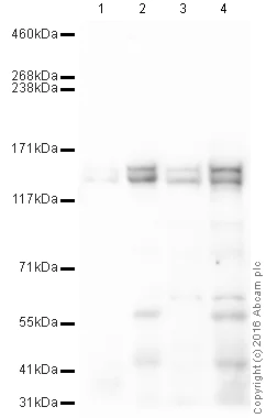 Western blot - Anti-SynGAP antibody [EPR2883Y] - BSA and Azide free (AB247491)