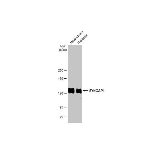 Western blot - Anti-SYNGAP1 antibody [HL2292] (AB317190)