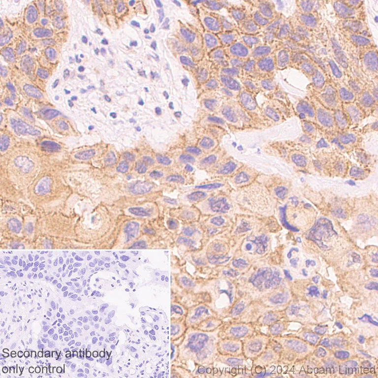 Immunohistochemistry (Formalin/PFA-fixed paraffin-embedded sections) - Anti-Synip antibody [EP302Y] (AB40674)