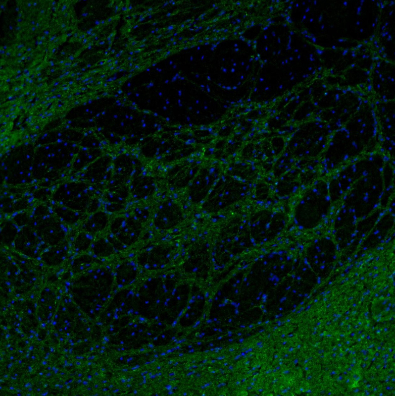 Immunocytochemistry/ Immunofluorescence - Anti-SYNJ2BP antibody - N-terminal (AB224217), expandable thumbnail
