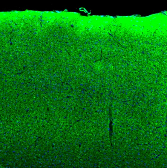 Immunocytochemistry/ Immunofluorescence - Anti-SYNJ2BP antibody - N-terminal (AB224217), expandable thumbnail