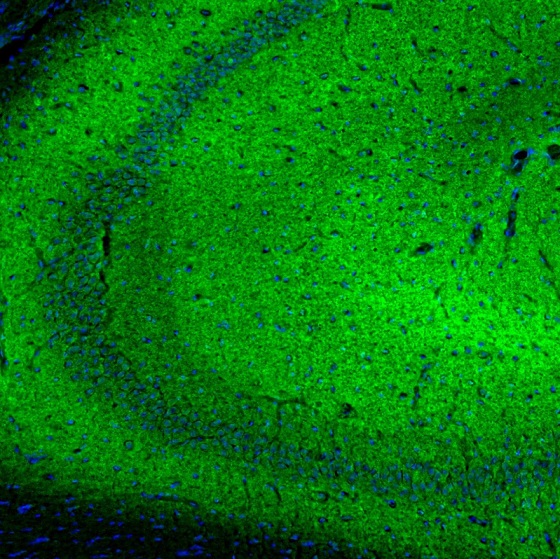 Immunocytochemistry/ Immunofluorescence - Anti-SYNJ2BP antibody - N-terminal (AB224217), expandable thumbnail