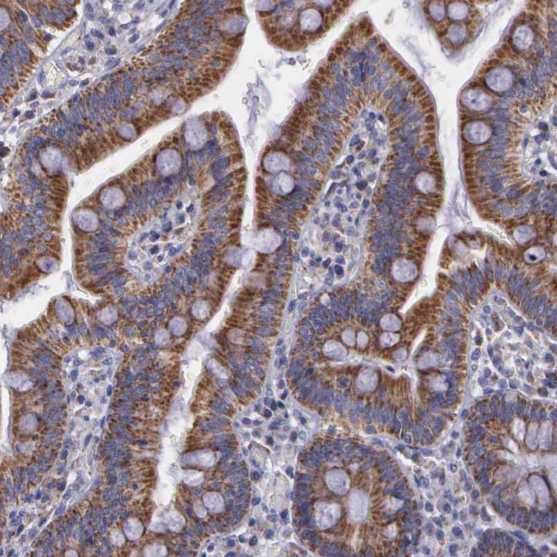 Immunohistochemistry (Formalin/PFA-fixed paraffin-embedded sections) - Anti-SYNJ2BP antibody - N-terminal (AB224217), expandable thumbnail