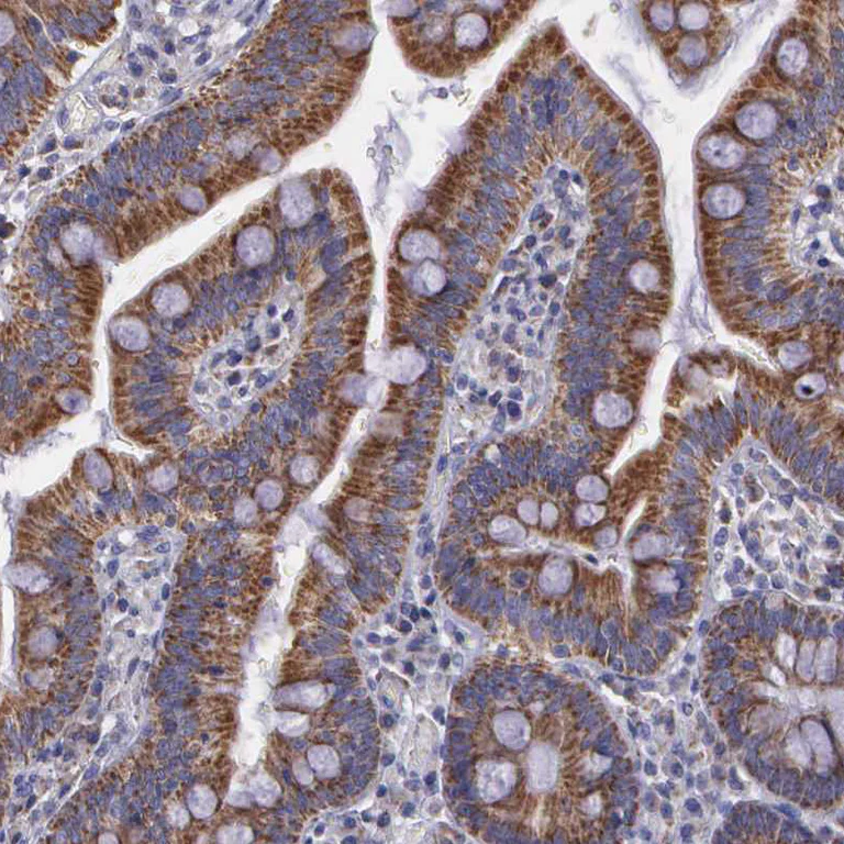 Immunohistochemistry (Formalin/PFA-fixed paraffin-embedded sections) - Anti-SYNJ2BP antibody - N-terminal (AB224217)