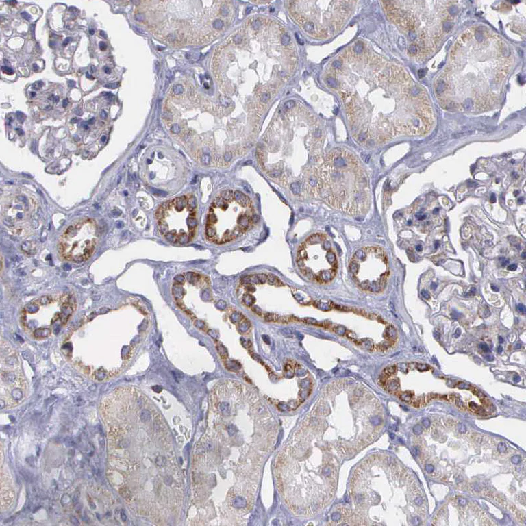 Immunohistochemistry (Formalin/PFA-fixed paraffin-embedded sections) - Anti-SYNJ2BP antibody - N-terminal (AB224217)