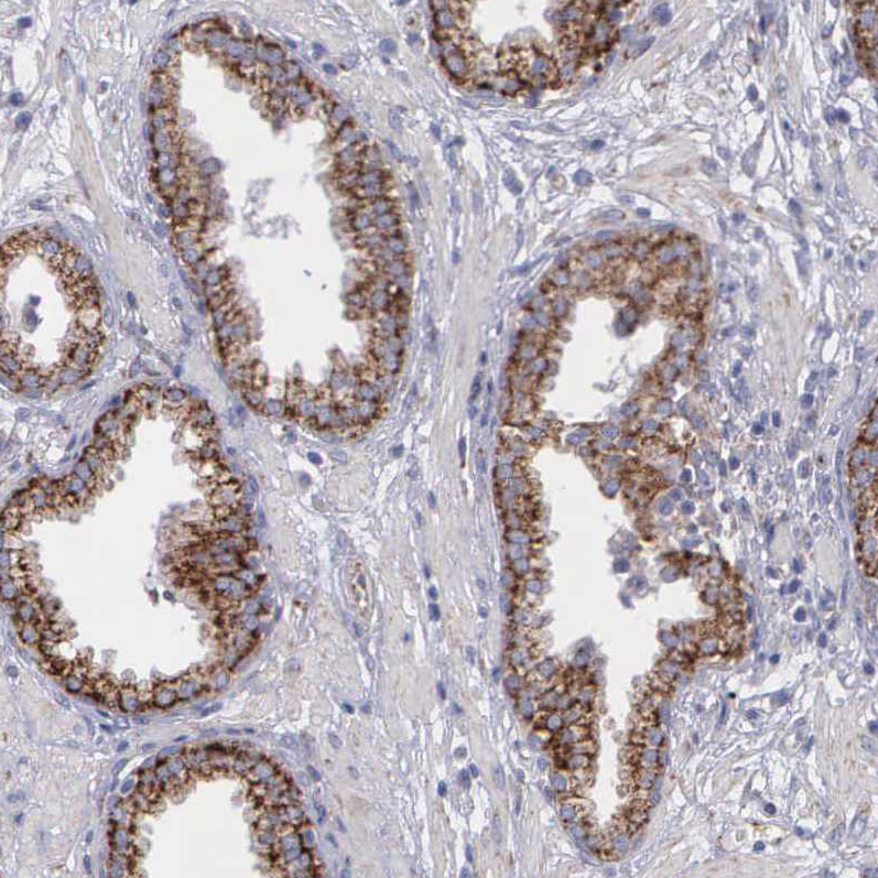 Immunohistochemistry (Formalin/PFA-fixed paraffin-embedded sections) - Anti-SYNJ2BP antibody - N-terminal (ab224217), expandable thumbnail