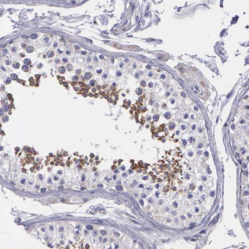 Immunohistochemistry (Formalin/PFA-fixed paraffin-embedded sections) - Anti-SYNJ2BP antibody - N-terminal (AB224217), expandable thumbnail