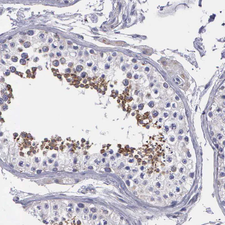 Immunohistochemistry (Formalin/PFA-fixed paraffin-embedded sections) - Anti-SYNJ2BP antibody - N-terminal (AB224217)