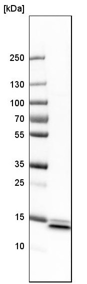Western blot - Anti-SYNJ2BP antibody - N-terminal (ab224217), expandable thumbnail