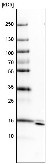 Western blot - Anti-SYNJ2BP antibody - N-terminal (ab224217), expandable thumbnail