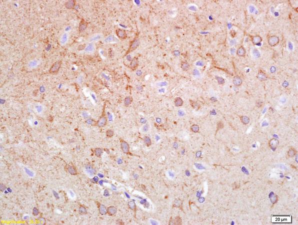 Immunohistochemistry (Formalin/PFA-fixed paraffin-embedded sections) - Anti-Synphilin 1 antibody (AB217373)