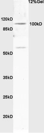 Western blot - Anti-Synphilin 1 antibody (AB217373)