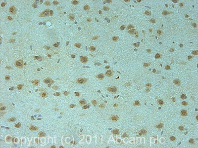 Immunohistochemistry (Formalin/PFA-fixed paraffin-embedded sections) - Anti-Synphilin 1 antibody (AB6179)