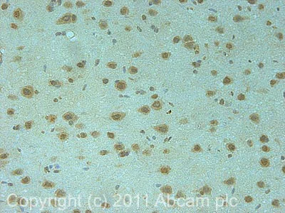 Immunohistochemistry (Formalin/PFA-fixed paraffin-embedded sections) - Anti-Synphilin 1 antibody (AB6179)
