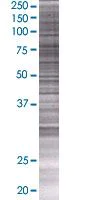 SDS-PAGE - Synphilin 1 overexpression 293T lysate (whole cell) (AB94102)