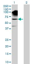 Western blot - Synphilin 1 overexpression 293T lysate (whole cell) (AB94102)