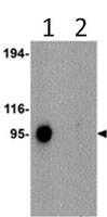 Western blot - Anti-SYNPO2L antibody (AB105421)