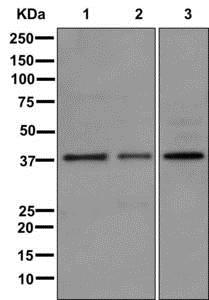 Western blot - Anti-SYNPR antibody [EPR11472] - BSA and Azide free (AB249875), expandable thumbnail