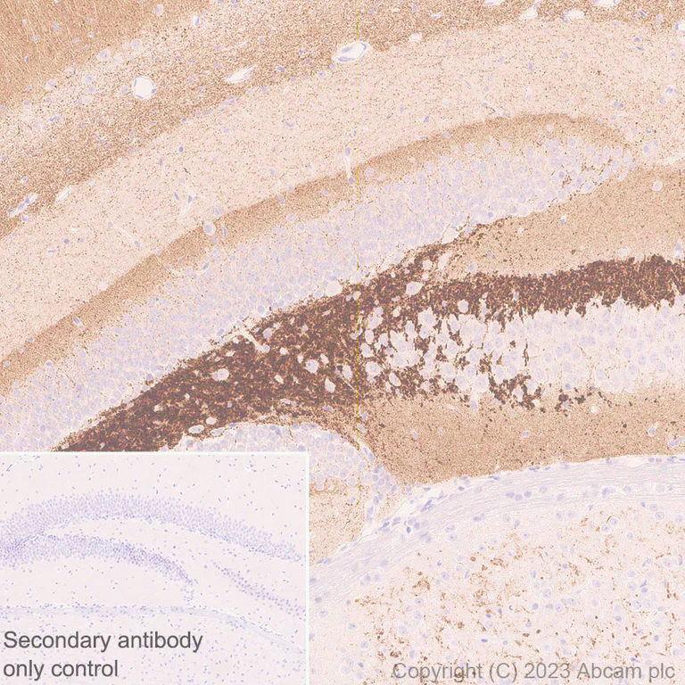 Immunohistochemistry (Formalin/PFA-fixed paraffin-embedded sections) - Anti-SYNPR antibody [EPR28139-74] (AB314136)