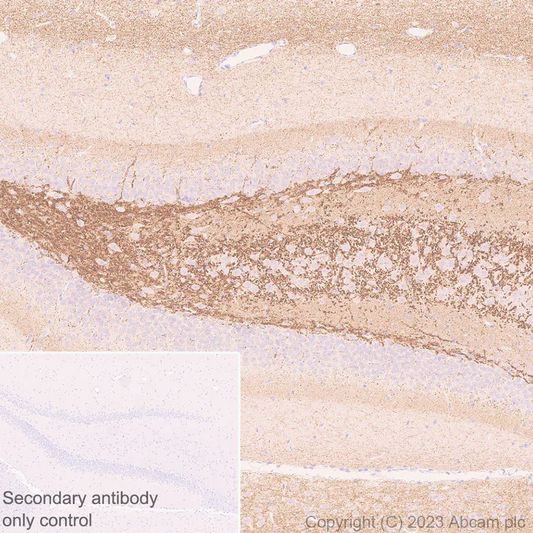 Immunohistochemistry (Formalin/PFA-fixed paraffin-embedded sections) - Anti-SYNPR antibody [EPR28139-74] (AB314136)