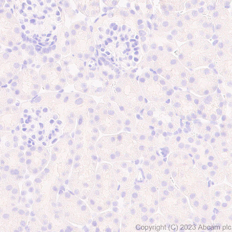 Immunohistochemistry (Formalin/PFA-fixed paraffin-embedded sections) - Anti-SYNPR antibody [EPR28139-74] (AB314136)