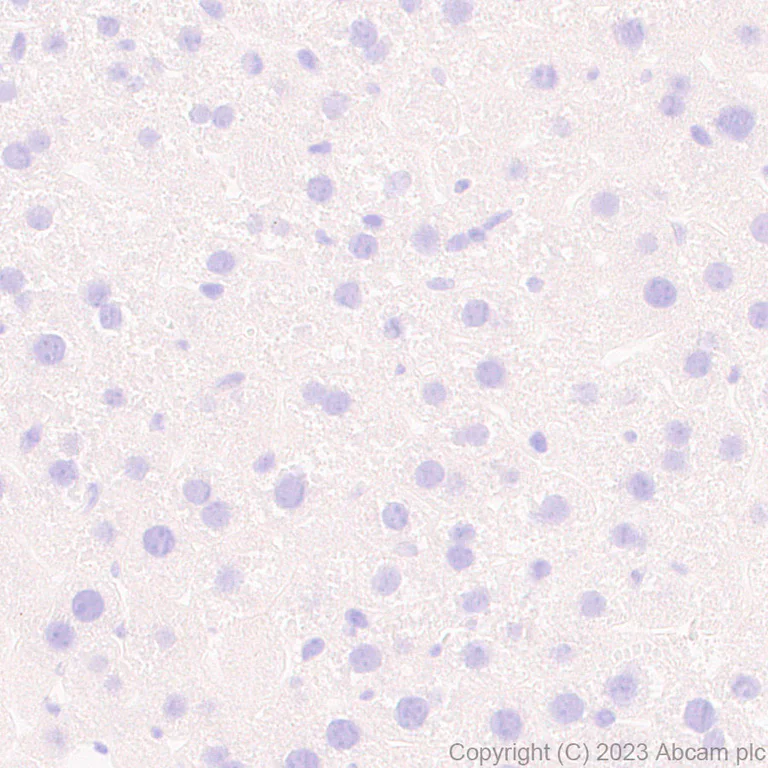 Immunohistochemistry (Formalin/PFA-fixed paraffin-embedded sections) - Anti-SYNPR antibody [EPR28139-74] (AB314136)