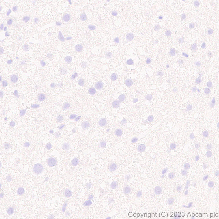 Immunohistochemistry (Formalin/PFA-fixed paraffin-embedded sections) - Anti-SYNPR antibody [EPR28139-74] (AB314136)